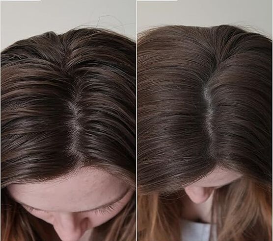 Kit Cuidado Capilar Briogeo Scalp Care